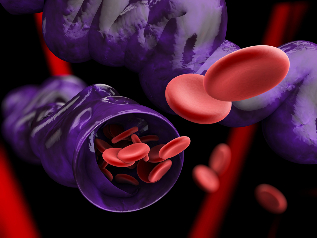 large varicose veins