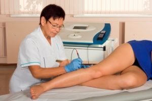 how to get rid of varicose veins treatment